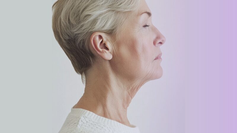 profile view of an older woman with short hair, showing prominent wrinkles and sagging skin on her neck, representing the condition of her skin before a neck lift procedure